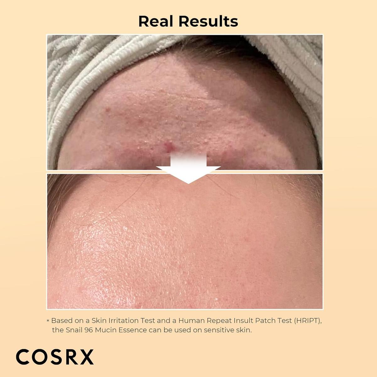 • CORSX Snail serum